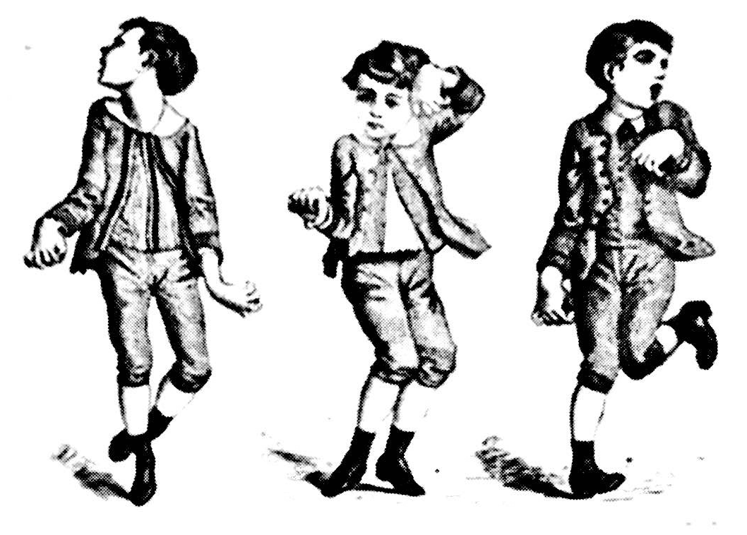 Sydenham’s chorea Rimikri Med